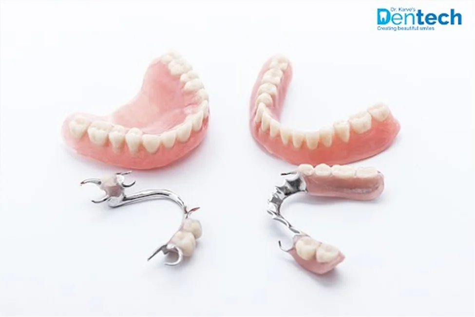 Partial Dentures Cost Treatment Types in India